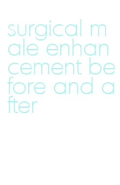 surgical male enhancement before and after