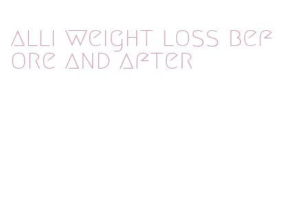 alli weight loss before and after