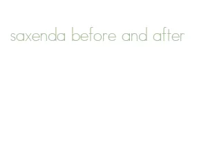 saxenda before and after