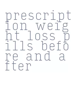 prescription weight loss pills before and after