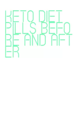 keto diet pills before and after