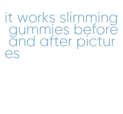 it works slimming gummies before and after pictures