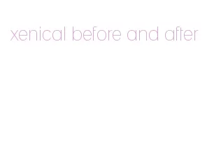 xenical before and after