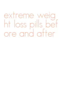extreme weight loss pills before and after