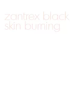 zantrex black skin burning