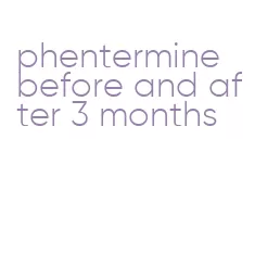 phentermine before and after 3 months