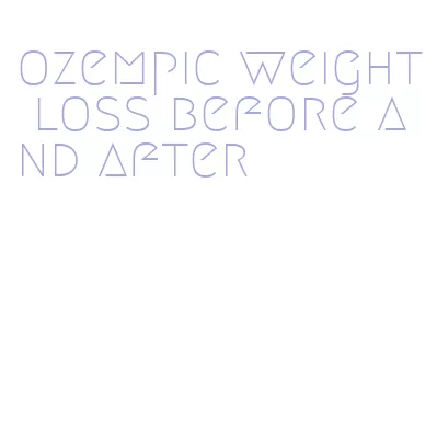 ozempic weight loss before and after