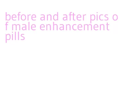before and after pics of male enhancement pills