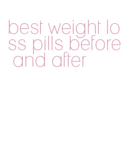 best weight loss pills before and after