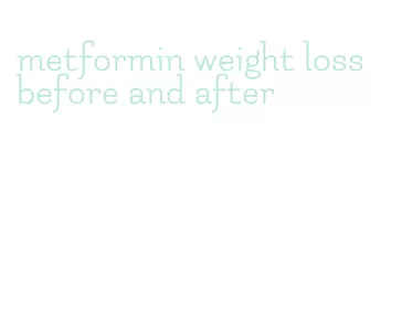 metformin weight loss before and after
