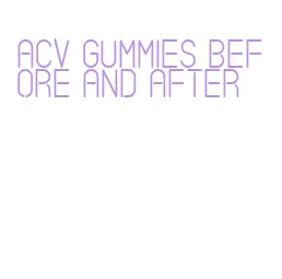 acv gummies before and after