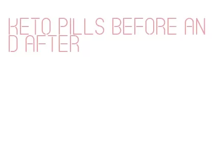 keto pills before and after